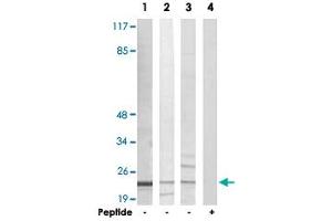 Western blot analysis of extracts from Jurkat cells (Lane 1 and lane 4), K-562 cells (Lane 2) and HUVEC cells (Lane 3), using AKAP14 polyclonal antibody . (AKAP14 抗体)