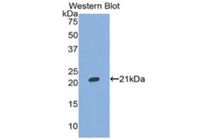 Western Blotting (WB) image for anti-Inter alpha Globulin Inhibitor H5 (ITIH5) (AA 569-737) antibody (ABIN1859514) (ITIH5 抗体  (AA 569-737))