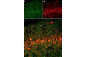 Expression of SERT in rat brain - Immunohistochemical staining of immersion-fixed, free floating rat brain frozen sections using Anti-Serotonin Transporter (SERT) (extracellular) Antibody (ABIN7043745, ABIN7044608 and ABIN7044609), (1:400). (SLC6A4 抗体  (4th Extracellular Loop))