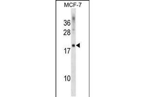 Western blot analysis in MCF-7 cell line lysates (35ug/lane). (CMTM5 抗体  (AA 62-88))