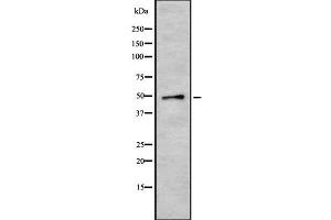 Western blot analysis of CRLF3 using HeLa whole cell lysates (CRLF3 抗体  (Internal Region))