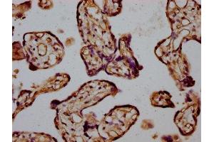 Immunohistochemistry (IHC) image for anti-Inverted Formin, FH2 and WH2 Domain Containing (INF2) (AA 926-1047) antibody (ABIN7157012)
