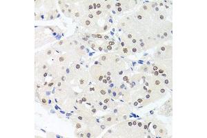 Immunohistochemistry of paraffin-embedded human stomach using HMGN1 antibody. (HMGN1 抗体  (AA 1-100))