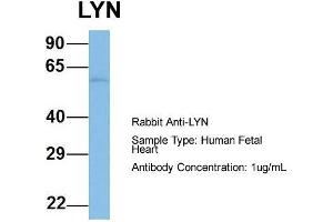 Host: Rabbit  Target Name: LYN  Sample Tissue: Human Fetal Heart  Antibody Dilution: 1. (LYN 抗体  (N-Term))