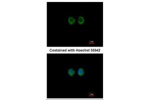 ICC/IF Image Immunofluorescence analysis of methanol-fixed A549, using RAGE, antibody at 1:100 dilution. (MOK 抗体)