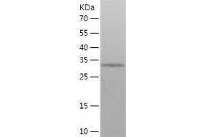 Western Blotting (WB) image for Protein Phosphatase 1, Catalytic Subunit, alpha Isoform (PPP1CA) (AA 1-330) protein (His tag) (ABIN7124661)