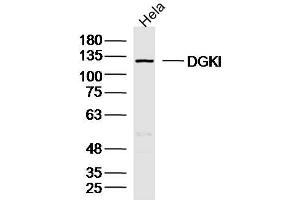 Hela lysates probed with DGKI Polyclonal Antibody, Unconjugated  at 1:300 dilution and 4˚C overnight incubation. (DGKI 抗体  (AA 101-200))