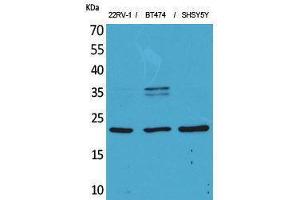 Western Blotting (WB) image for anti-Fibroblast Growth Factor 12 (FGF12) (Internal Region) antibody (ABIN3187704) (FGF12 抗体  (Internal Region))