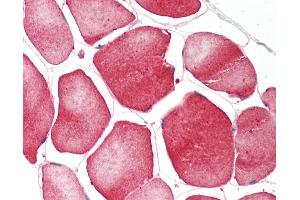 Immunohistochemistry (IHC) image for anti-ATPase, Ca++ Transporting, Cardiac Muscle, Slow Twitch 2 (ATP2A2) (AA 794-843) antibody (ABIN6755314)