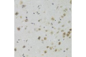 Immunohistochemistry of paraffin-embedded mouse brain using PAWR Antibody (ABIN5971565) at dilution of 1/100 (40x lens). (PAWR 抗体)