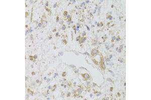 Immunohistochemistry (Paraffin-embedded Sections) (IHC (p)) image for anti-Cytokine Induced Apoptosis Inhibitor 1 (CIAPIN1) (AA 1-312) antibody (ABIN6138619)