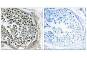 Immunohistochemistry analysis of paraffin-embedded human tesophagusis tissue using GIDRP88 antibody. (GIDRP88 抗体)