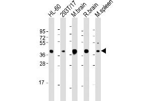 ALDOC Antibody (C-term) (ABIN1882192 and ABIN2843477) western blot analysis in HL-60,293 cell line and mouse brain,spleen lysates (35 μg/lane). (ALDOC 抗体)