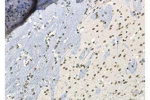ABIN6261763 and ABIN6266541 at 1/100 staining Mouse brain tissue by IHC-P.