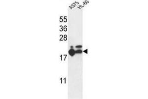 RPL17 Antibody (C-term) western blot analysis in A375,HL-60 cell line lysates (35µg/lane). (RPL17 抗体  (C-Term))