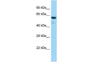 Host: Rabbit Target Name: Gtf3c5 Sample Type: Rat Stomach lysates Antibody Dilution: 1. (GTF3C5 抗体  (Middle Region))