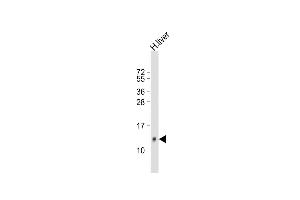 Anti-HP Antibody (Center) at 1:500 dilution + human liver lysate Lysates/proteins at 20 μg per lane. (Hepcidin 抗体  (AA 17-46))