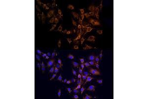 Immunofluorescence analysis of C6 cells using RPL10A Rabbit pAb (ABIN6129099, ABIN6147103, ABIN6147104 and ABIN6221624) at dilution of 1:100 (40x lens). (RPL10A 抗体  (AA 1-110))