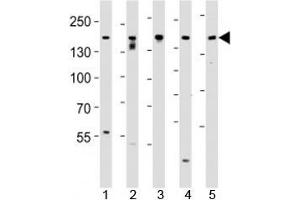 Western blot analysis of lysate from SH-SY5Y, MCF-7, PC3, LNCaP, HeLa, cell line (left to right) using Tuberin antibody at 1:1000 for each lane. (Tuberin 抗体  (AA 1776-1805))