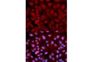Immunofluorescence (IF) image for anti-Synuclein, gamma (Breast Cancer-Specific Protein 1) (SNCG) antibody (ABIN1874888) (SNCG 抗体)