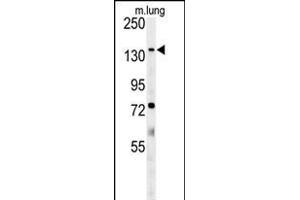 ATP11C Antibody (Center) (ABIN651638 and ABIN2840341) western blot analysis in mouse lung tissue lysates (35 μg/lane). (ATP11C 抗体  (AA 589-616))