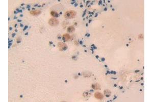 Detection of RORg in Human Lung Tissue using Polyclonal Antibody to RAR Related Orphan Receptor Gamma (RORg)