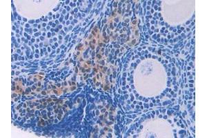 Used in DAB staining on fromalin fixed paraffin- embedded kidney tissue