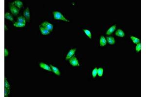 Immunofluorescent analysis of HepG2 cells using ABIN7172803 at dilution of 1:100 and Alexa Fluor 488-congugated AffiniPure Goat Anti-Rabbit IgG(H+L) (TACC3 抗体  (AA 133-268))
