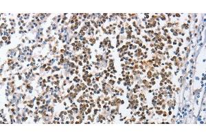 Immunohistochemistry of paraffin-embedded Human tonsil using MCM6 Polyclonal Antibody at dilution of 1:45 (MCM6 抗体)