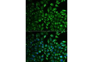 Immunofluorescence analysis of A549 cell using IMPA1 antibody. (IMPA1 抗体)