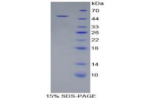 SDS-PAGE analysis of Human PSMC2 Protein. (PSMC2 蛋白)