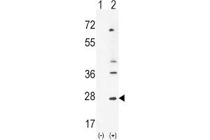 Western Blotting (WB) image for anti-Leukemia Inhibitory Factor (LIF) antibody (ABIN3002910) (LIF 抗体)