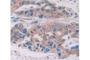 IHC-P analysis of Human Tissue, with DAB staining. (GZMM 抗体  (AA 26-257))