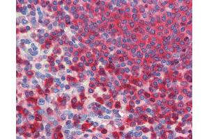 Anti-G6PD antibody IHC of human spleen.