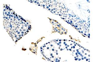TGF beta 1 Mouse monoclonal Antibody at 1/100 staining Rat brain tissue by IHC-P.