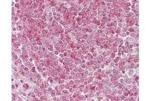 Anti-RIPK3 / RIP3 antibody IHC of human spleen. (RIPK3 抗体  (AA 251-300))