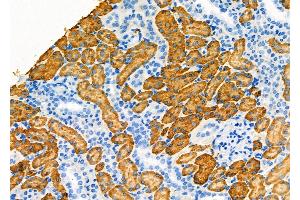 ABIN6257932 and ABIN6275132 at 1/100 staining Rat kidney tissue by IHC-P. (ALDOB 抗体  (C-Term))