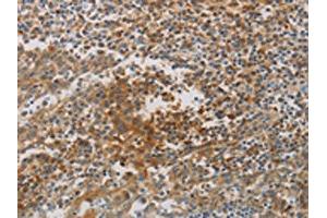 The image on the left is immunohistochemistry of paraffin-embedded Human tonsil tissue using ABIN7190267(CKMT1A/CKMT1B Antibody) at dilution 1/80, on the right is treated with synthetic peptide. (CKMT1A 抗体)