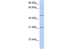 WB Suggested Anti-SLC39A11 Antibody Titration:  0. (SLC39A11 抗体  (Middle Region))