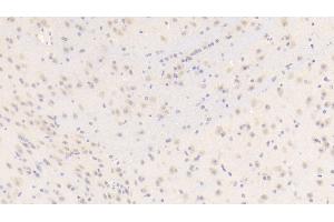 Immunohistochemistry (IHC) image for anti-Biglycan (BGN) (AA 53-166) antibody (ABIN7436627)