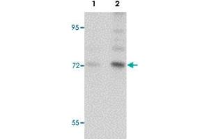 Western blot analysis of BALB/3T3 cells with ARHGAP18 polyclonal antibody  at (Lane 1) 1 and (Lane 2) 2 ug/mL dilution. (ARHGAP18 抗体  (C-Term))