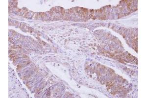 Image no. 1 for anti-Drebrin 1 (DBN1) (AA 401-596) antibody (ABIN1497770) (DBN1 抗体  (AA 401-596))