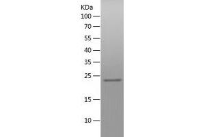 Western Blotting (WB) image for Zinc Finger CCCH-Type, Antiviral 1 (ZC3HAV1) (AA 190-377) protein (His tag) (ABIN7125771) (ZC3HAV1 Protein (AA 190-377) (His tag))