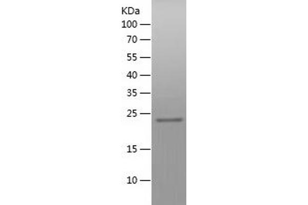 ZC3HAV1 Protein (AA 190-377) (His tag)