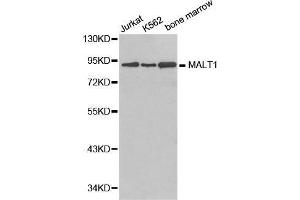 Western blot analysis of extracts of various cell lines, using MALT1 antibody. (MALT1 抗体  (AA 125-450))