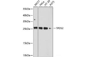 Western blot analysis of extracts of various cell lines using TPD52 Polyclonal Antibody at dilution of 1:1000. (TPD52 抗体)