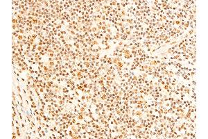 ABIN6267237 at 1/100 staining human appendiceal tissue sections by IHC-P. (FOXO3 抗体  (pSer253))