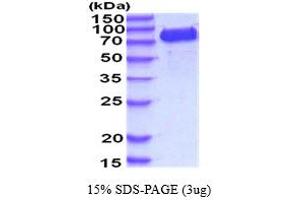 SDS-PAGE (SDS) image for Vascular Cell Adhesion Molecule 1 (VCAM1) (AA 25-698) protein (His tag) (ABIN5854444) (VCAM1 Protein (AA 25-698) (His tag))