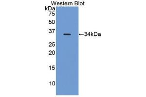 Detection of Recombinant HIF1a, Human using Polyclonal Antibody to Hypoxia Inducible Factor 1 Alpha (HIF1a)