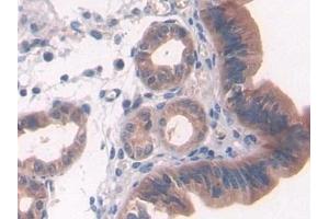 Detection of PTCH1 in Mouse Uterus Tissue using Polyclonal Antibody to Patched Homolog 1 (PTCH1) (Patched 1 抗体  (AA 213-422))